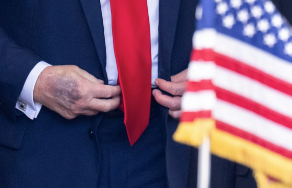 އަތުގައި ކުރަގަނޑެއް ނެގީ އެސްޕިރިން ކާތީ: ޓްރަމްޕު